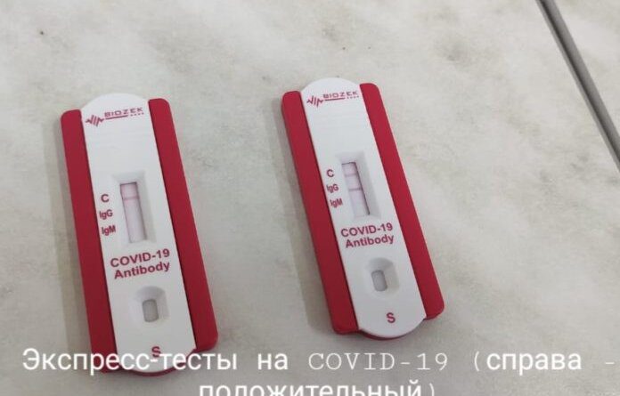 В Коми поступят новые экспресс-тесты для выявления коронавируса